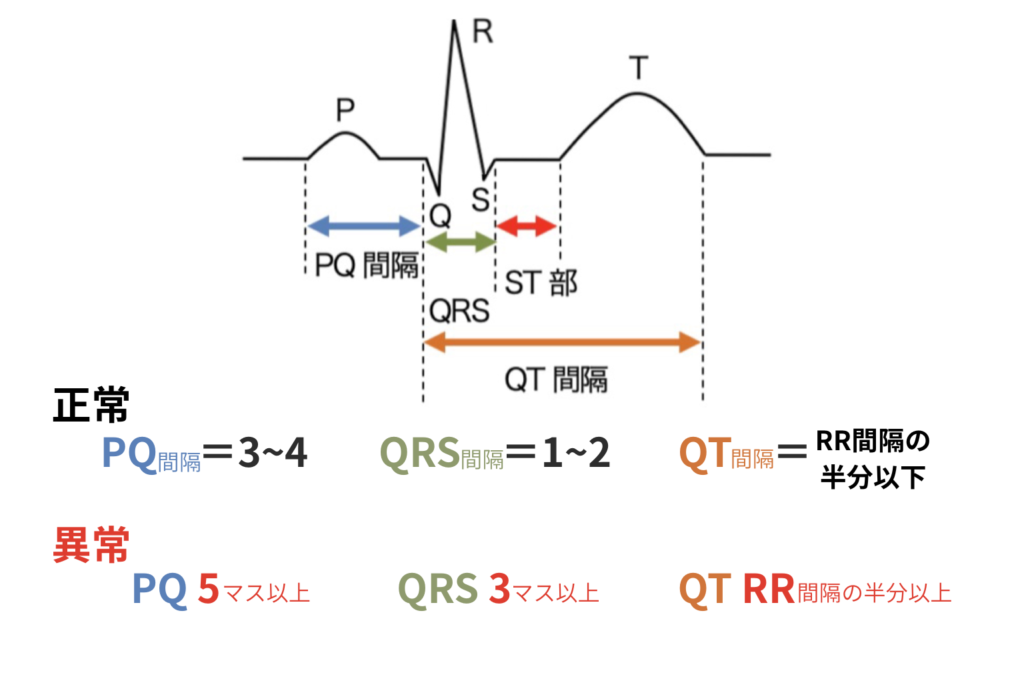心電図基本波形