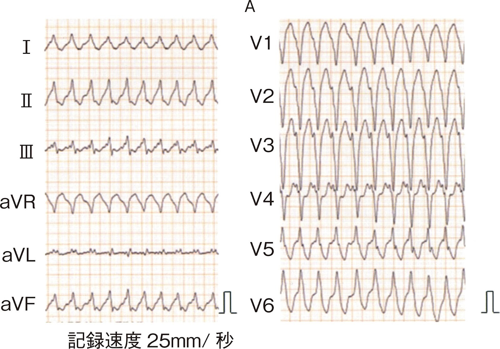 113F30 図1枚目