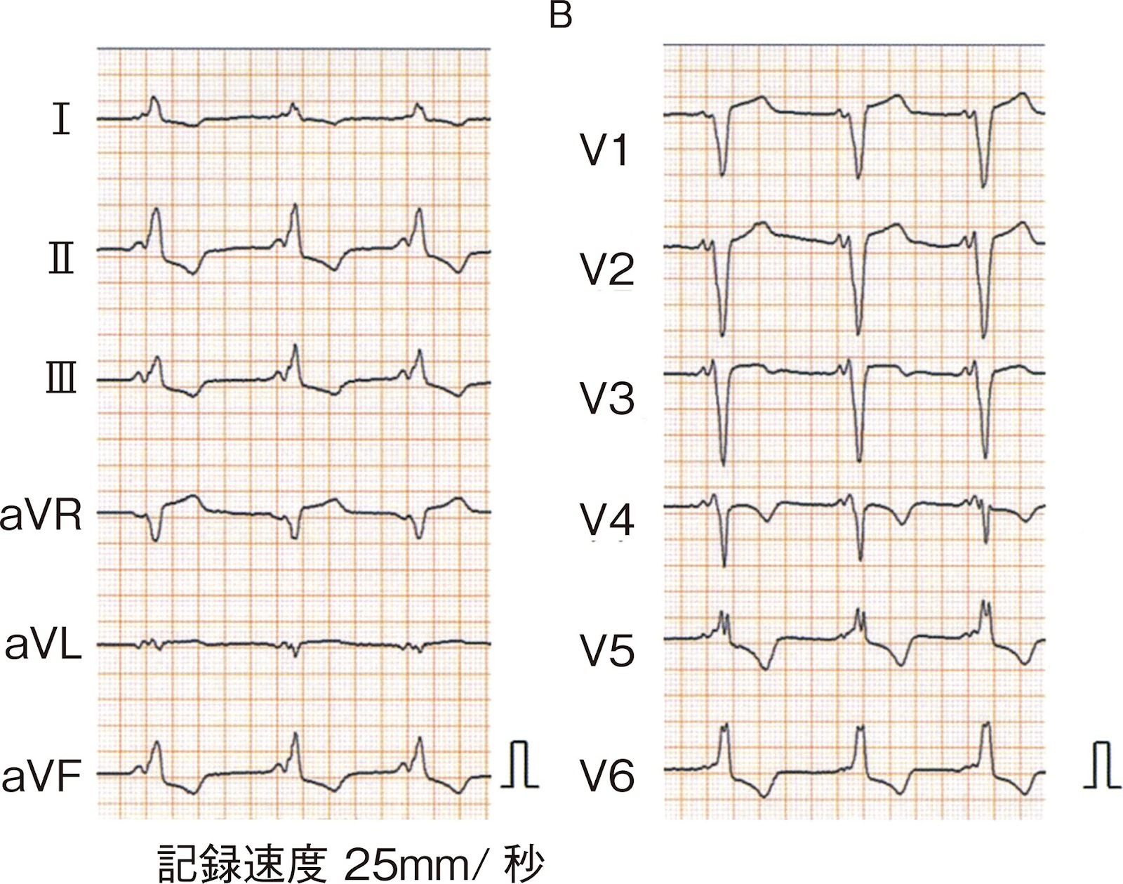 113F30 図2枚目