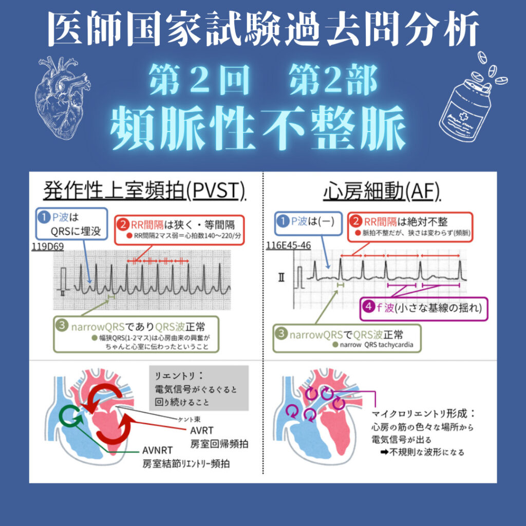 頻脈性不整脈 解説ブログ